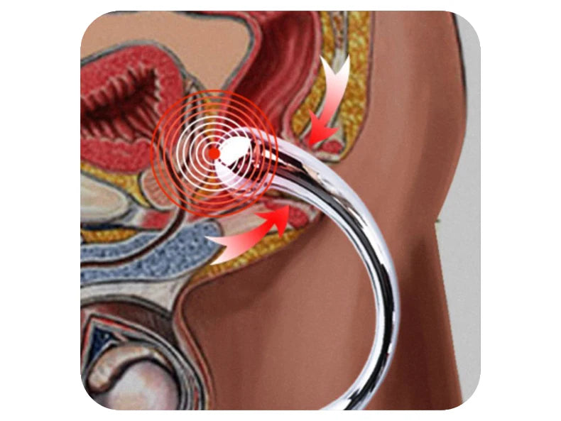 Metal Anal Plug Double Ended Stainless Steel G Spot Wand Butt Plug Prostate Massage Anal Dildo Plug Adult Sex Toys for Men Women